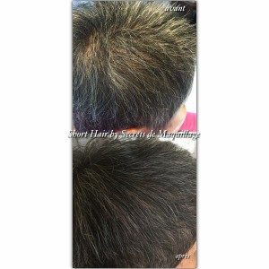 DensCapilSDM1 tricopigmentation densité capillaire